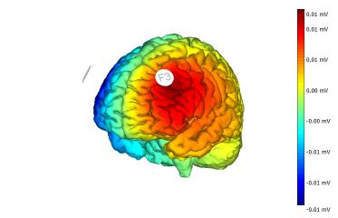 La tDCS